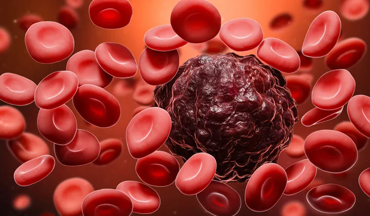 How blood cancer in some can progress as a disease - The Week