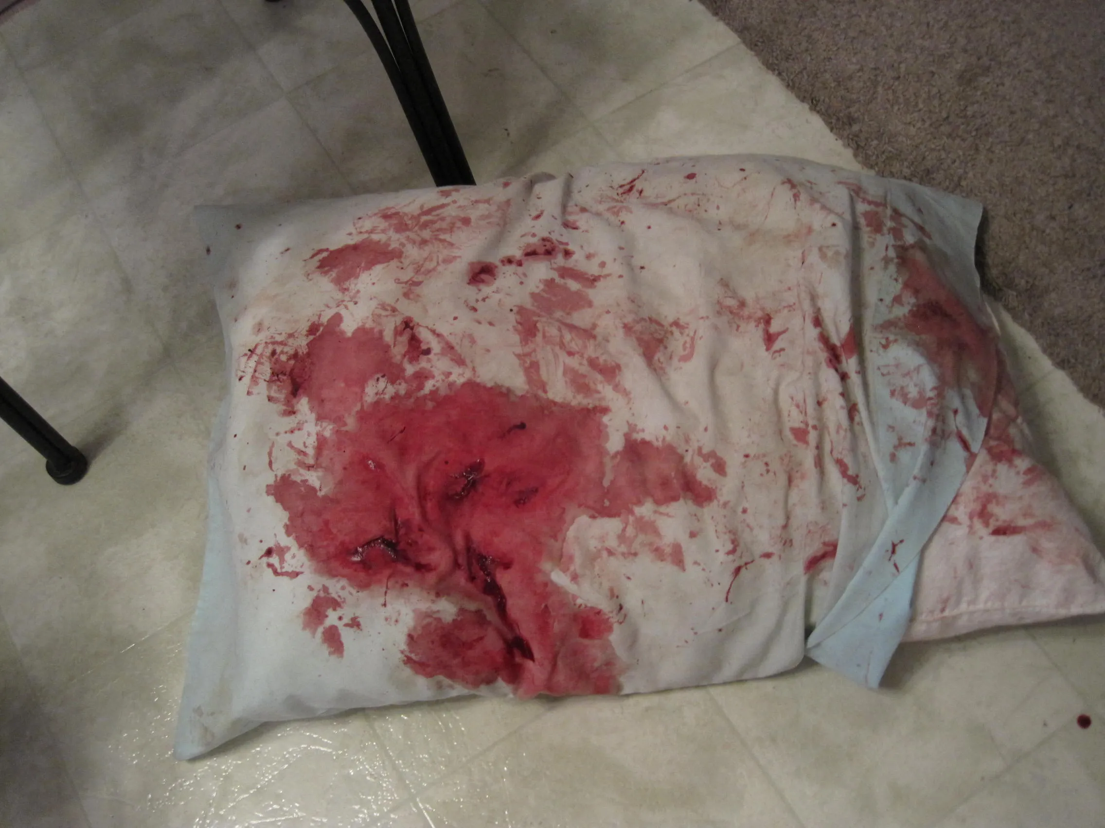 oxi-clean for blood stains | Lifetransplanet