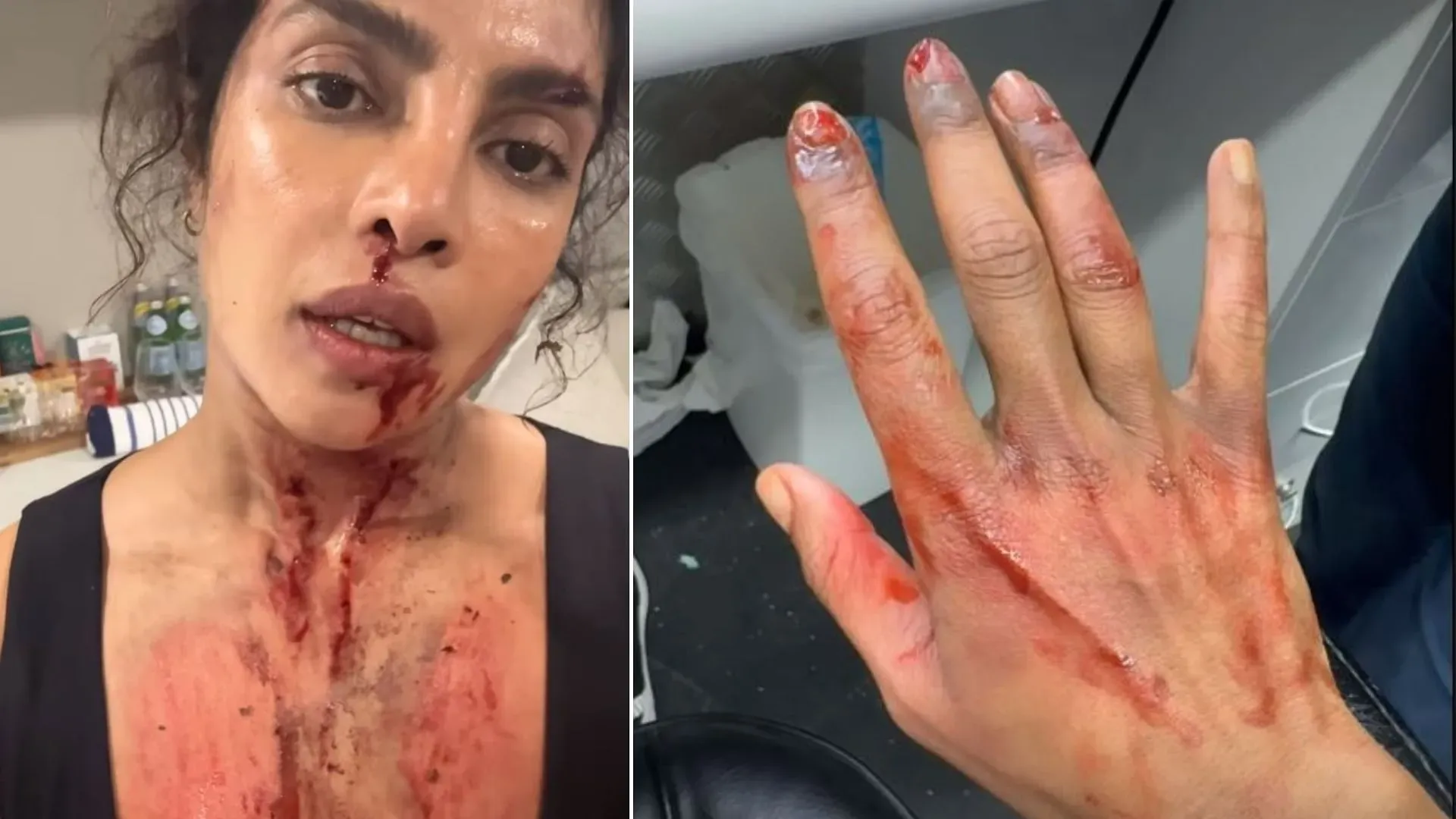 Priyanka Chopra Shares Clip Of Injured Hand from Her Upcoming Film The Bluff its just a makeup