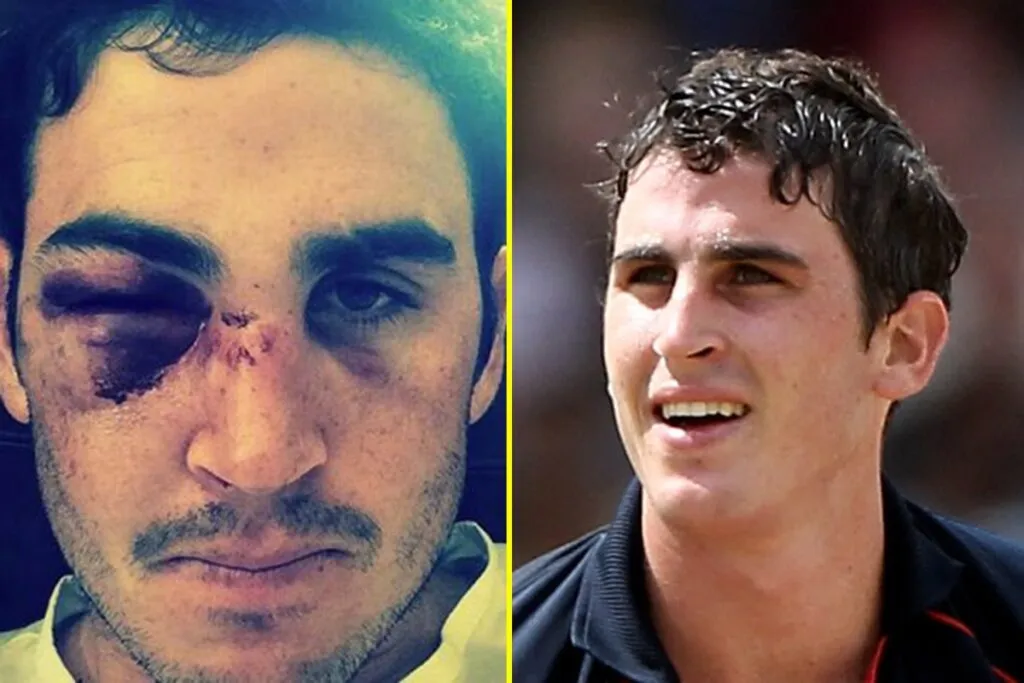 Craig Kieswetter