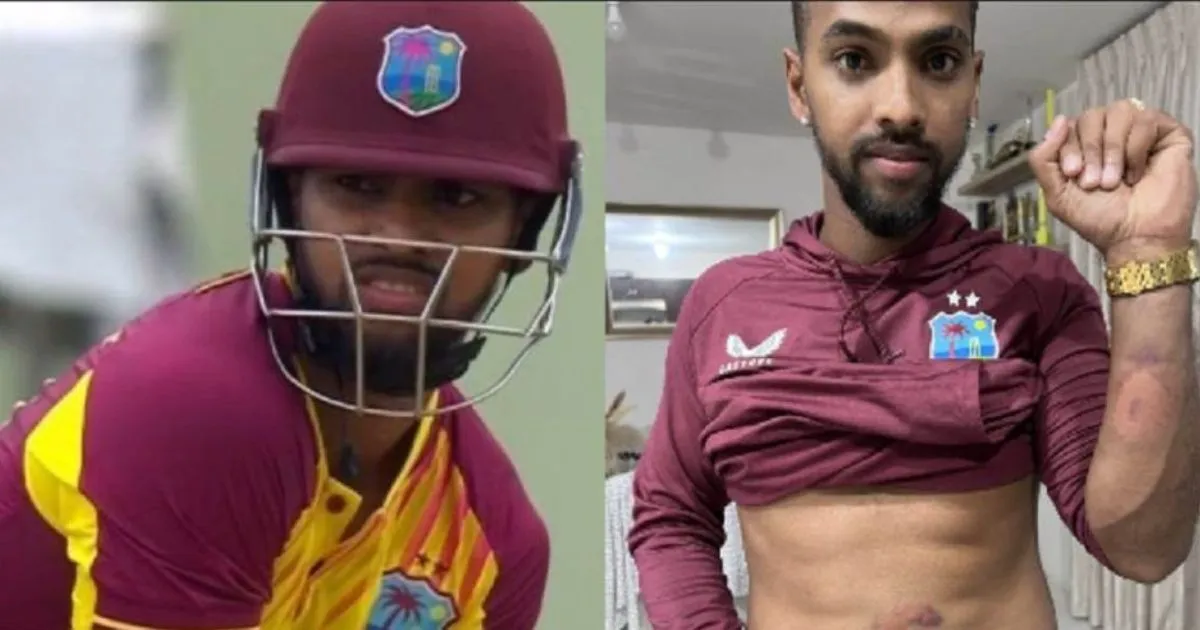  Nicholas Pooran , Arshdeep Singh , Ind vs WI
