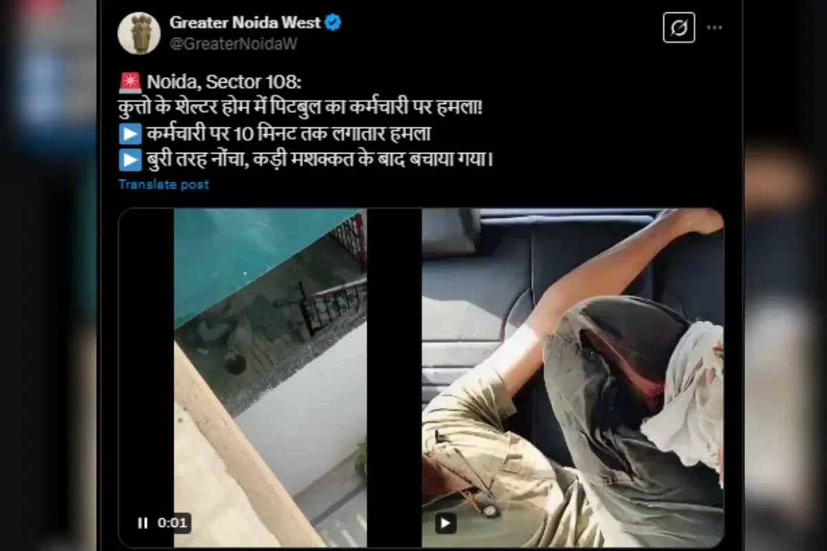 Noida pitbull attack