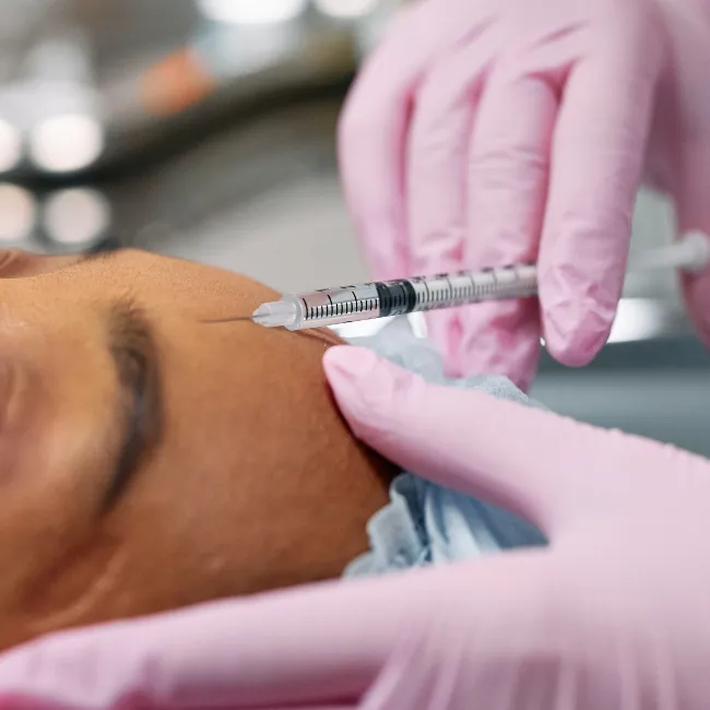 Facial Fillers