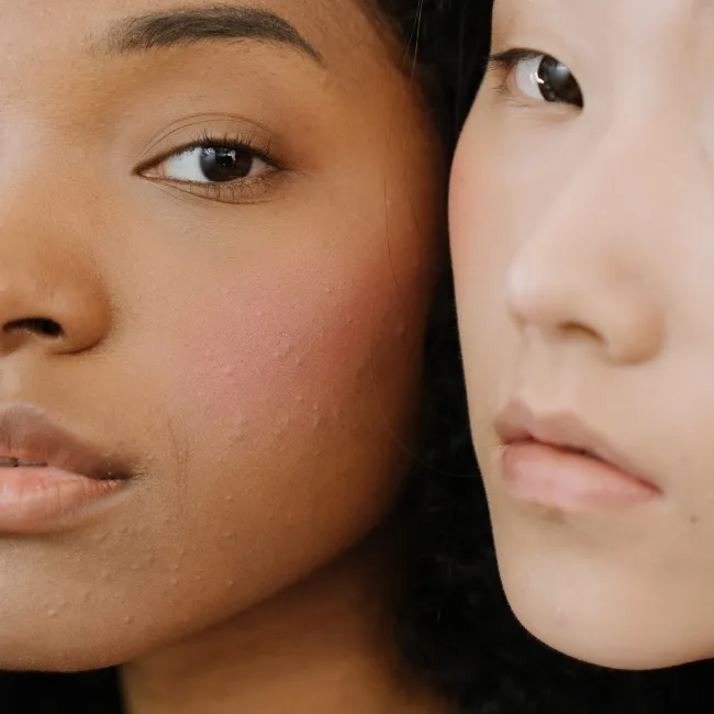 Ingredient Combinations for clear skin