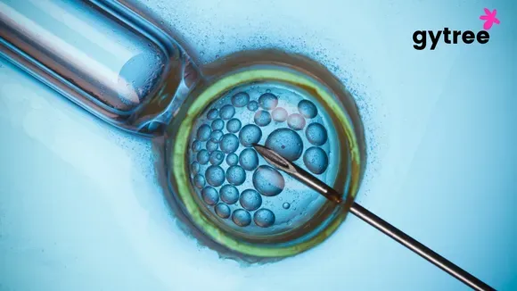 Ivf