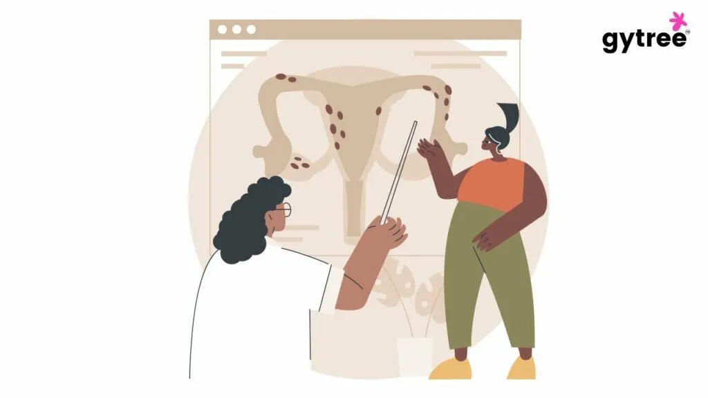 What is endometriosis?