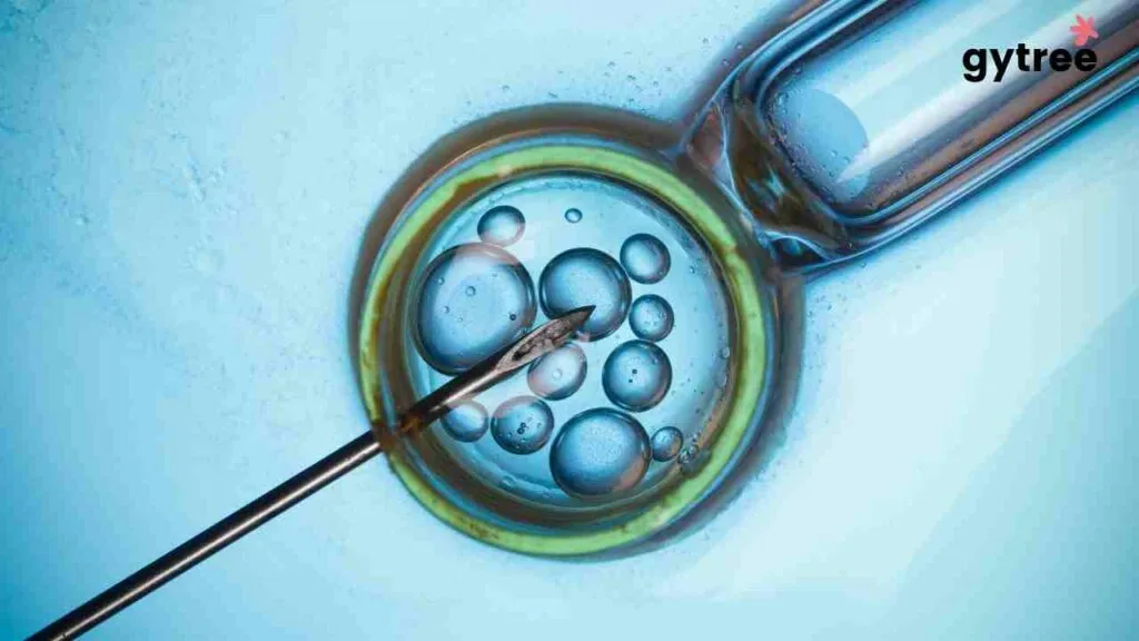 IVF in PCOS