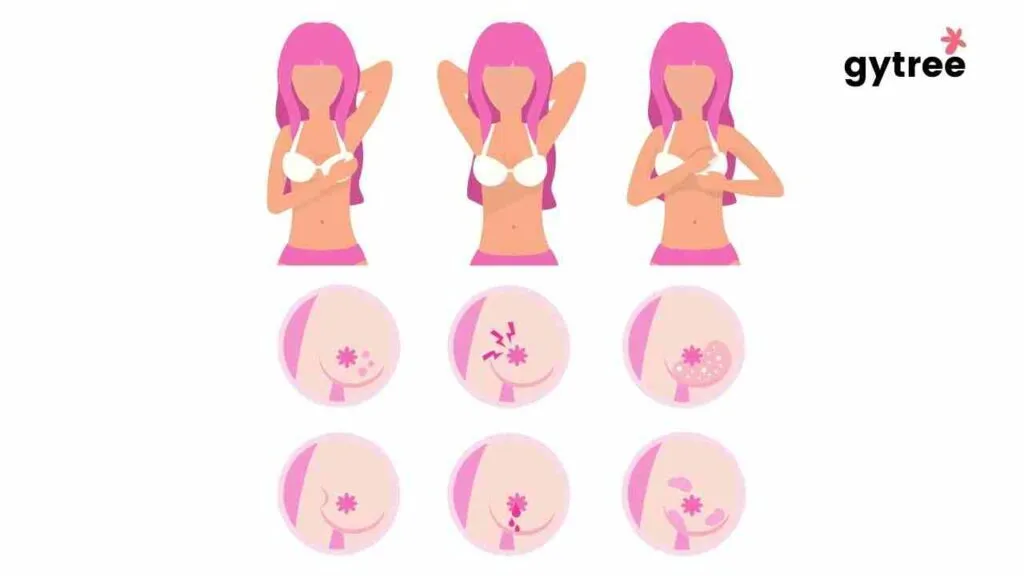 Self Breast Examination: Importance and Need 