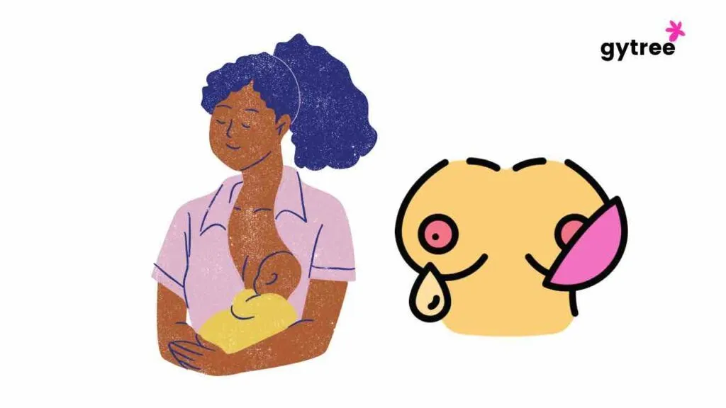Sore nipples postpartum