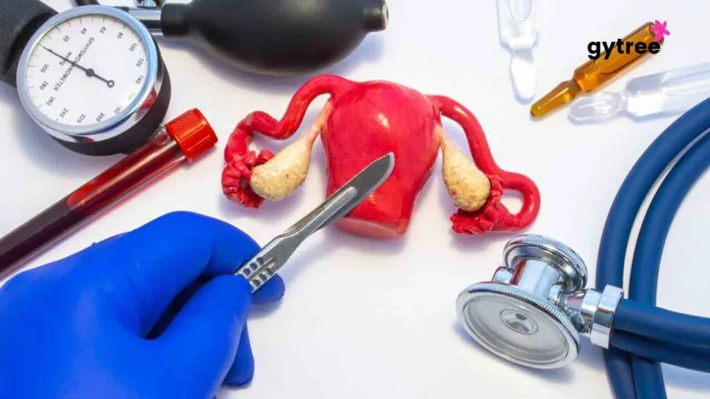 Hysterectomy
