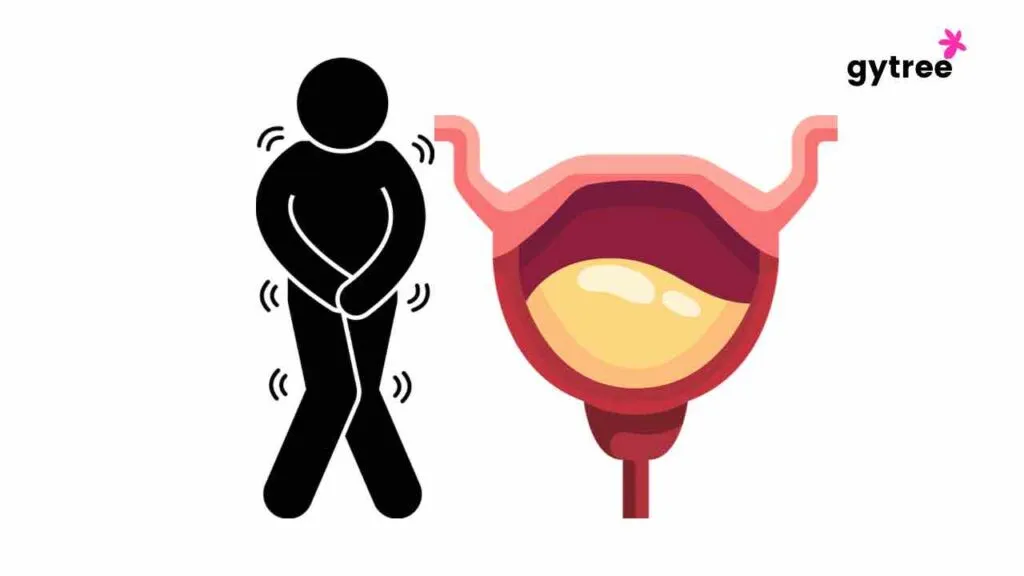 Urine leakage during menopause: Basic Management
