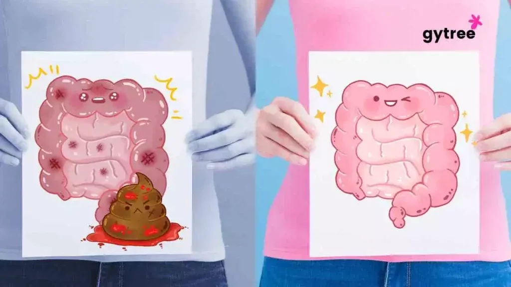 Causes of constipation due to lifestyle