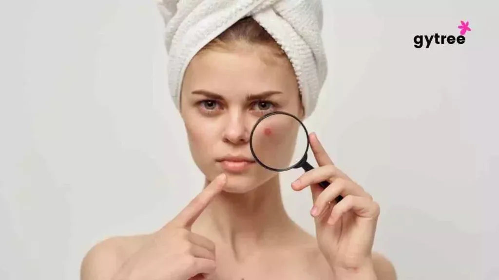 Break out? Here’s what your skin telling you!