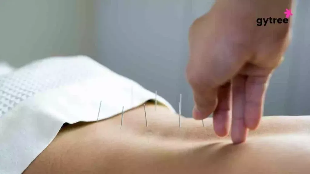 Acupuncture points and their benefits.