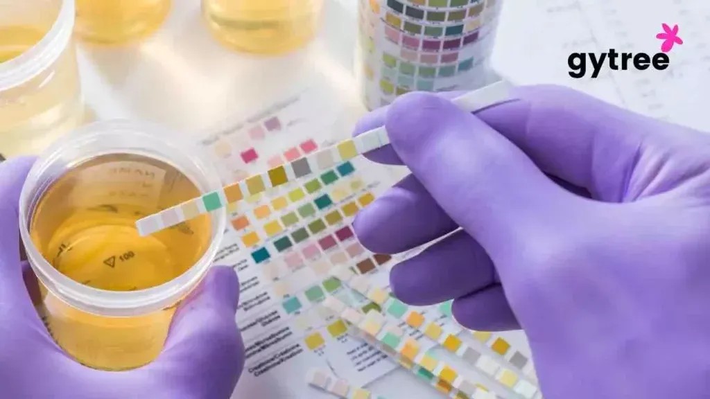 What your urine colour tells about your health?