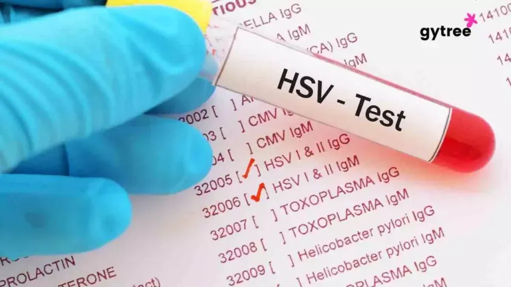 Demystifying STD Screening: Your Guide to Well-being