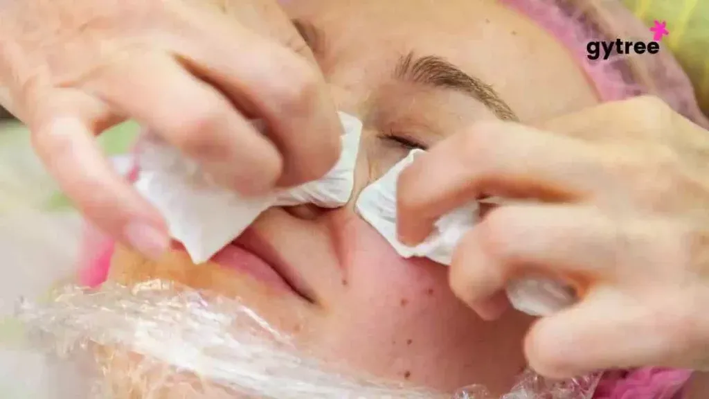 Acne and Pigmentation: 9 Effective ways to manage.