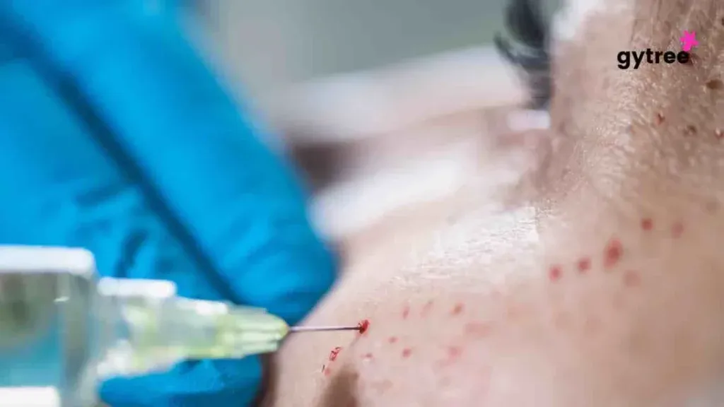 The Vampire Facial Mystery: From Twilight to Reality with 1 Route