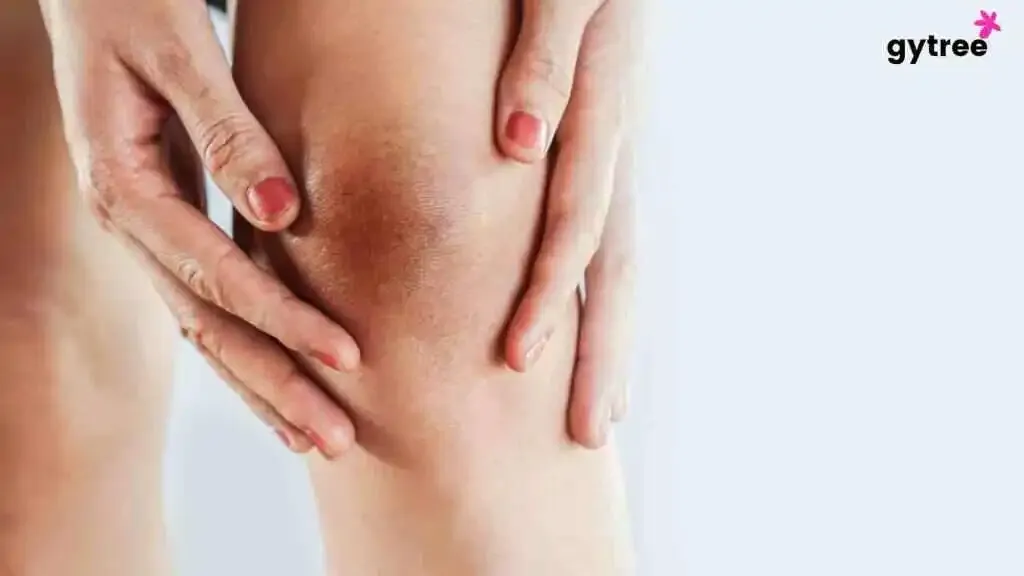Bye-Bye Dark Elbows and Knees: Welcoming the Radiance!
