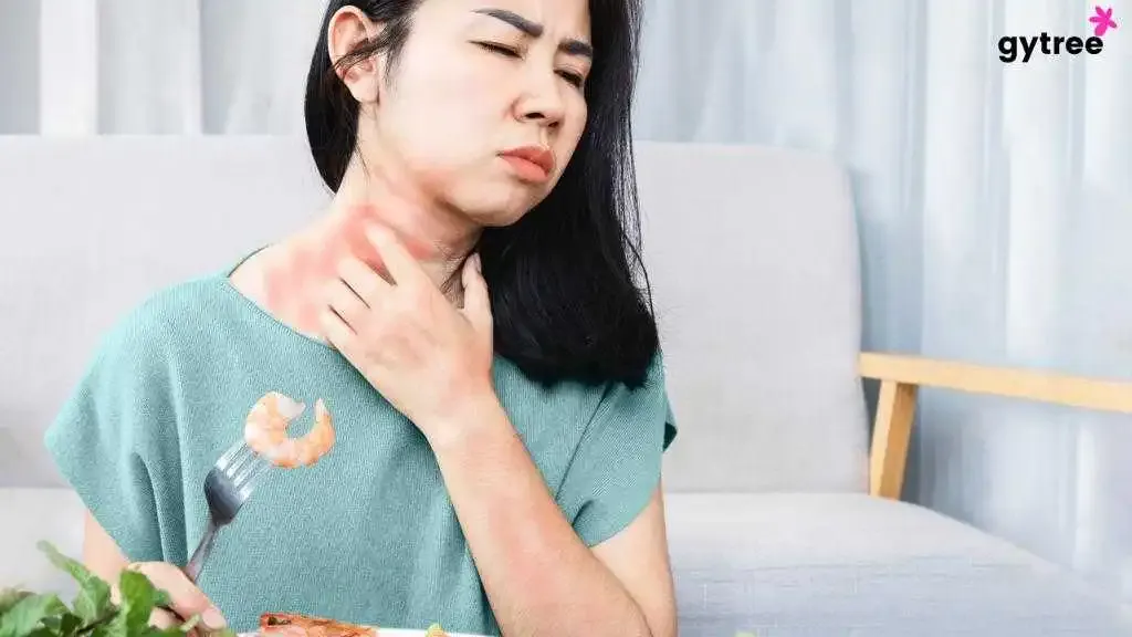 Adah Sharma's Hives Skin Condition: Her Battle With The Disease