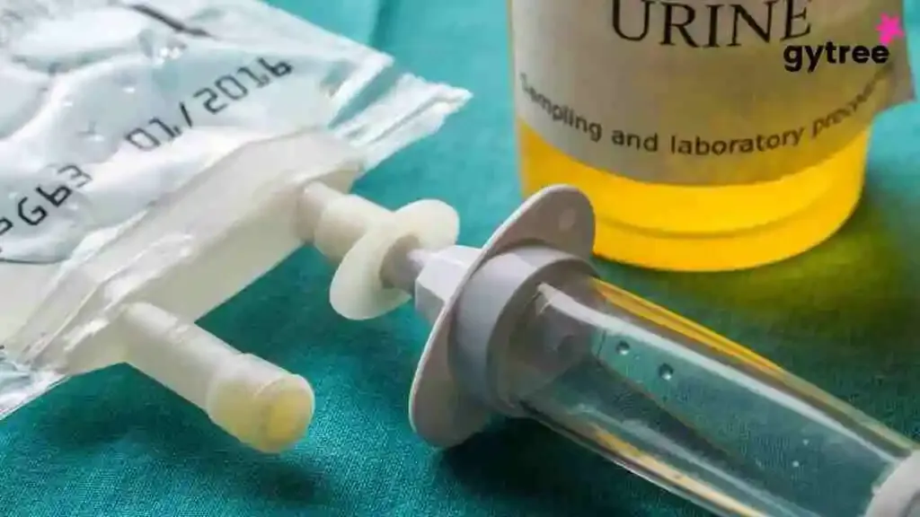 Recognizing 10 Urine Infection Symptoms That Are Too Common
