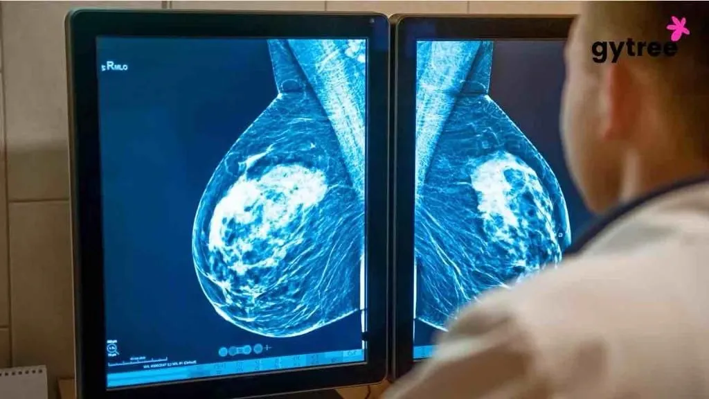 Mammogram Test- Illuminating Women's Health