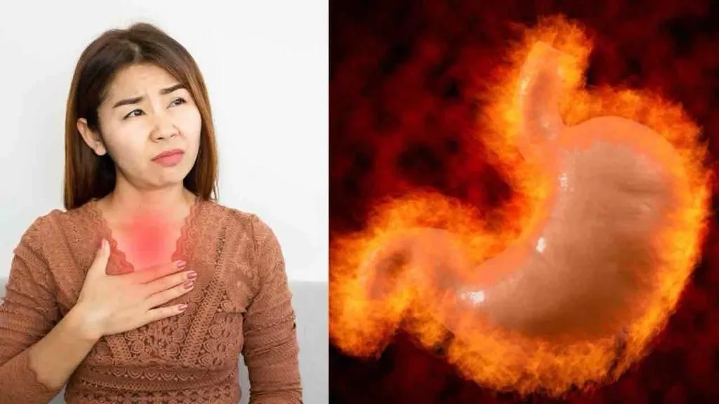 Acid Reflux in Women: Don't let the burn get to you!