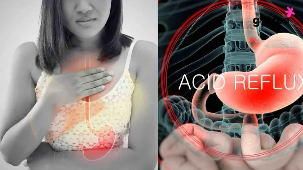 Acid Reflux in Women: Don't let the burn get to you!