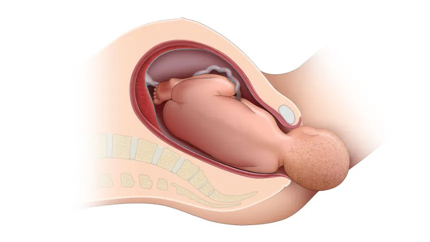 Vagina after childbirth.png(Image Credit:Flo Health)