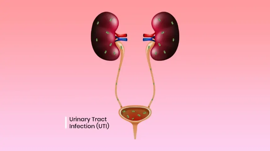 UTI0.png (Image Credit:Redcliffe Labs)