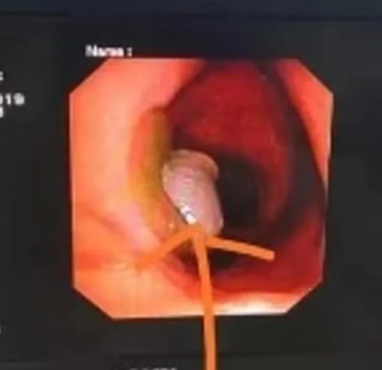 publive-image