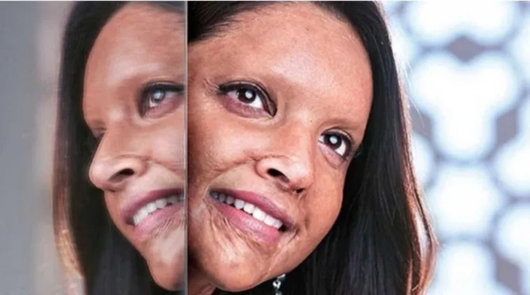 Deepika Padukone in Chhapaak