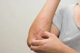 k6