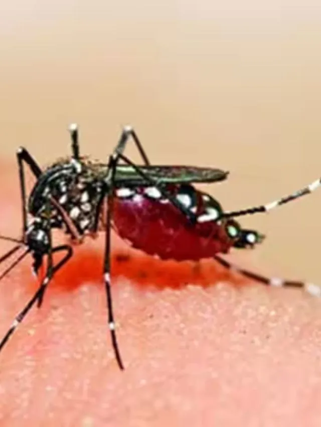 Dengue Fever And Care