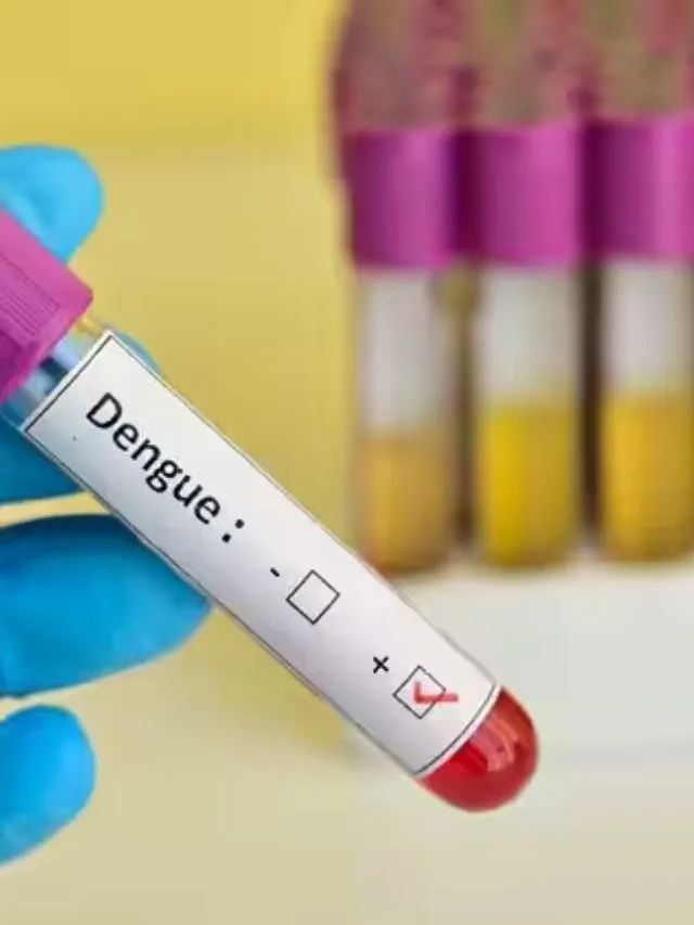 Dengue Fever And Care