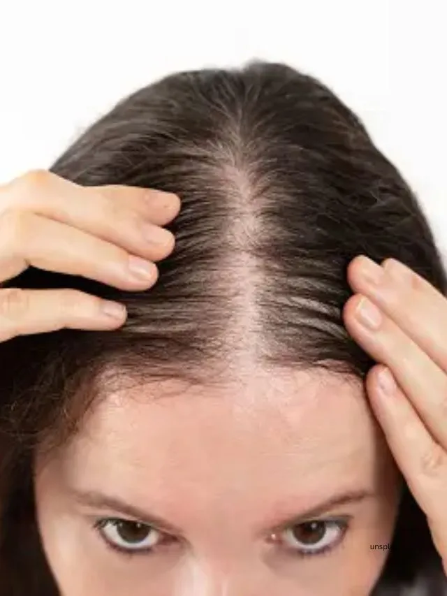 Vitamin-D-And-Hair-Loss (Unsplash)
