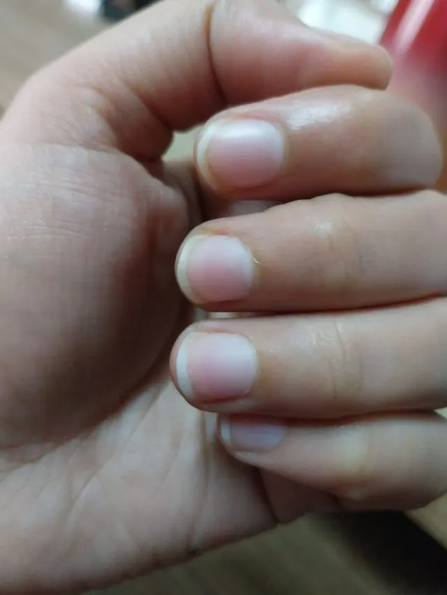 Fingernails (unsplash)