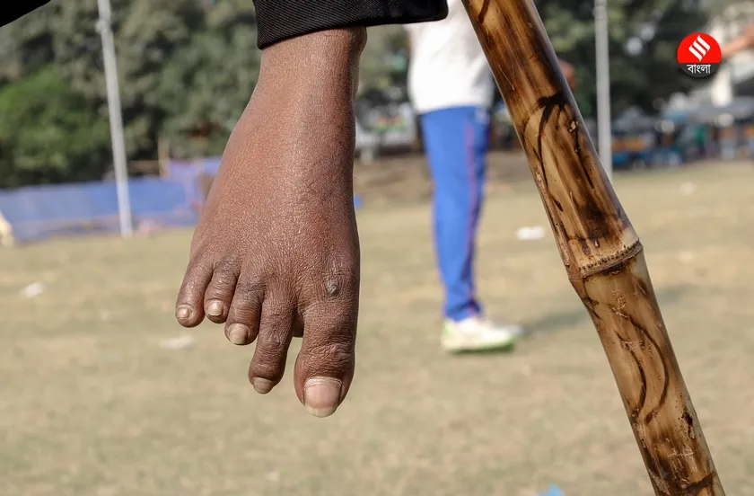 Ramesh Yadav | Para cricketer | differently abled cricketer | Bengal Cricketer