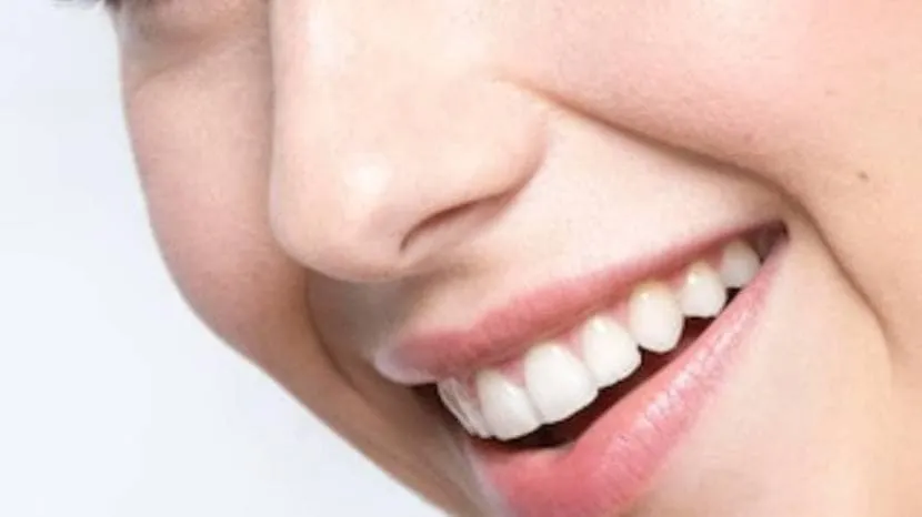 To Get Shiny Bright White Teeth At Home Must Try To These Six Home Remedies