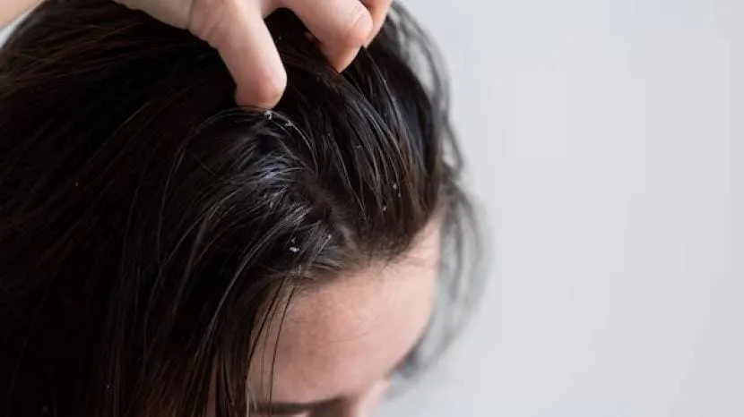 diy diy homemade ayurvedic hair masks amla bhringraj coconut oil rice water effective for premature graying hair white hair ayurvedic hair masks amla bhringraj coconut oil rice water effective for premature graying hair white hair