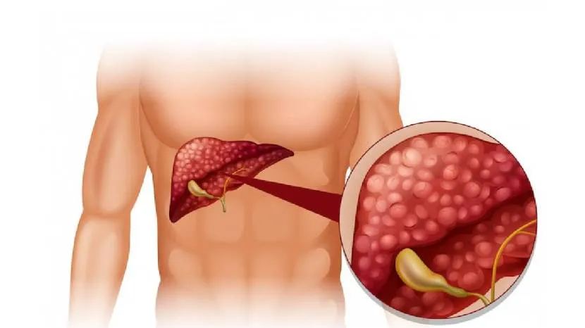 Yoga For A Healthy Liver