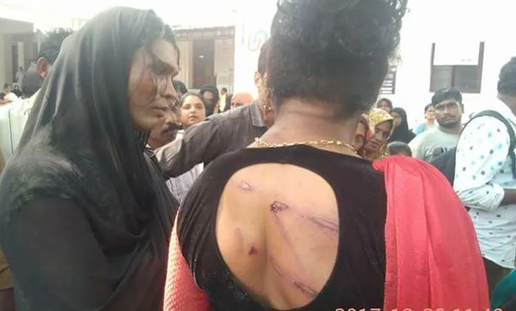 Kozhikode, Kochi, Transgenders, transgender attacked issue, police case, kozhikode SI, inquiry against police