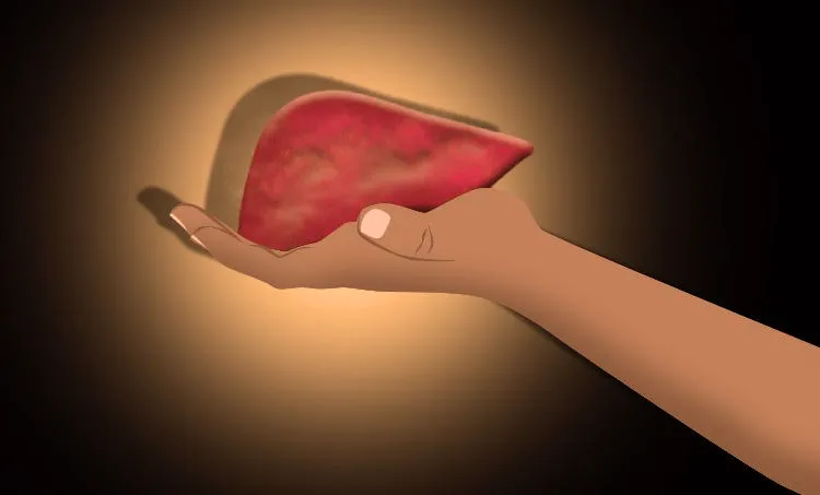 world-liver-day-fatty-liver-non-alcoholic-fatty-liver-cirrhosis