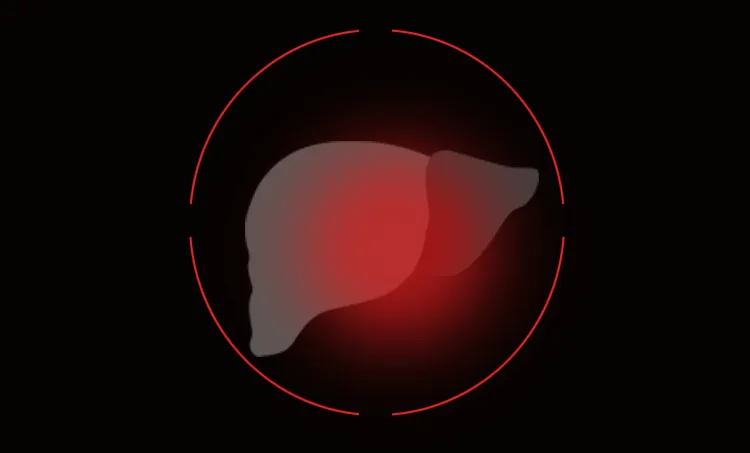 world-liver-day-fatty-liver-non-alcoholic-fatty-liver-cirrhosis