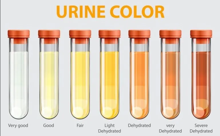 urine 