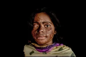 acid_attack.jpg__640x426_q85_crop_subsampling-2_upscale