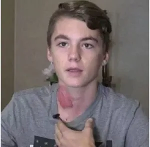 publive-image