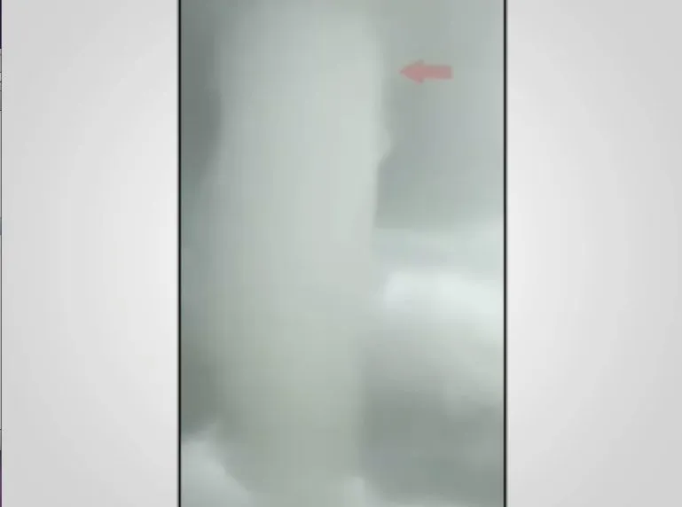 publive-image