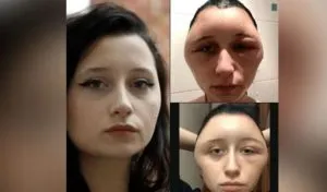 publive-image