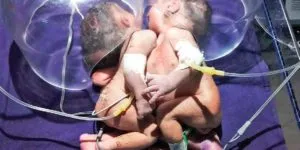 publive-image